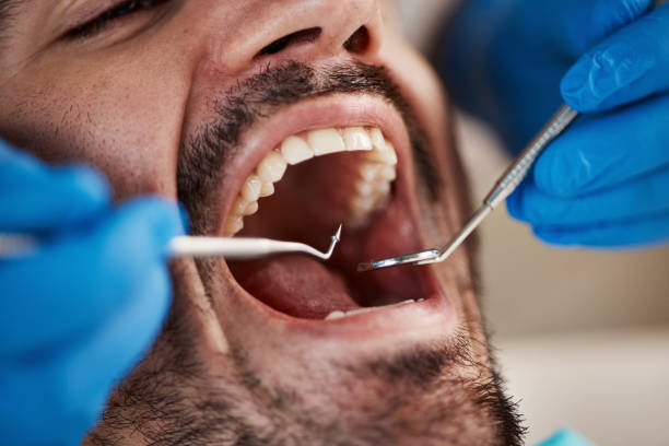 Best Emergency Gum Treatment in Quakertown, PA